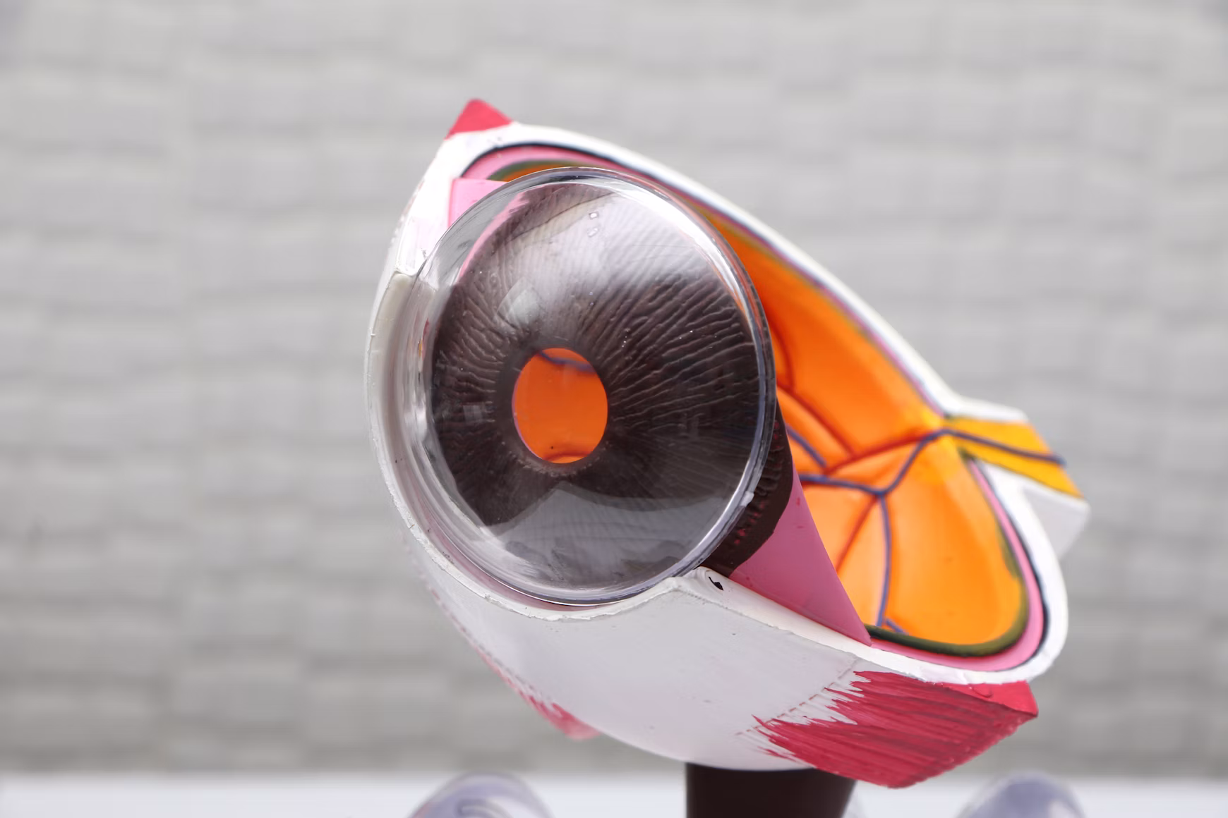 LASIK Eye Surgery: What to Expect and What It Doesn't Fix